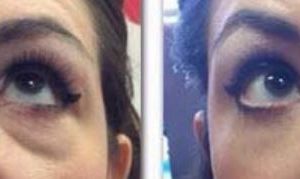 Instant Miracle Lifting Serum Bags/Dark Circles