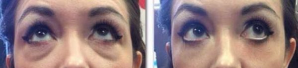 Instant Miracle Lifting Serum Bags/Dark Circles - Image 2