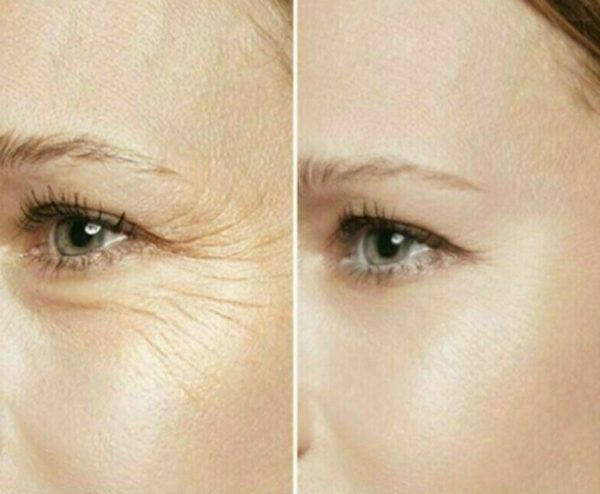 Instant Miracle Lifting Serum Bags/Dark Circles - Image 3